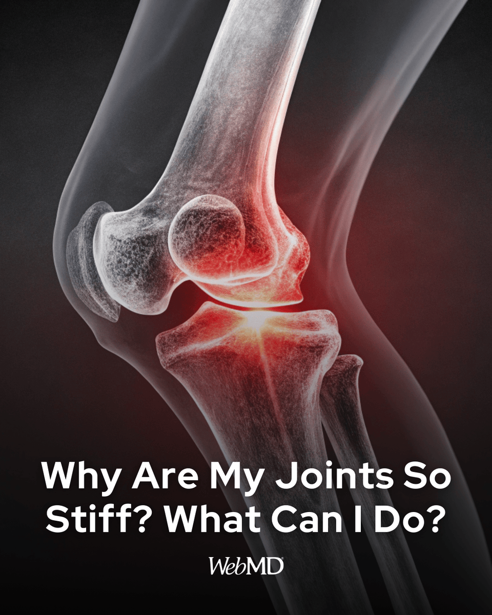 WebMD's tweet image. When you’re asleep and still for several hours, the fluid that helps your joints move easily can’t do its job. That’s why you wake up with knees or hands that are stiff and swollen. How to make it better: wb.md/4rhDNyf