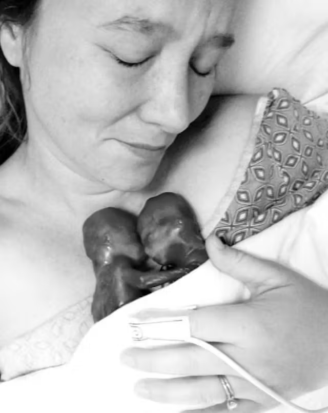 LiveAction's tweet image. Walter and Clark were twins miscarried at 19 weeks.

Their photos shared by their mother are a powerful reminder of their humanity, and the humanity of all preborn children.