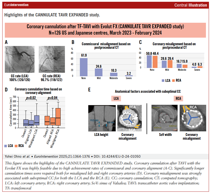 EuroInterventio's tweet image. The CANNULATE TAVR EXPANDED study reported high feasibility of coronary cannulation after TAVI with the Evolut FX. Post-TAVI CT showed high rates of commissural and coronary alignment, while misalignment was the strongest predictor of delayed or suboptimal cannulation.
#TAVI…