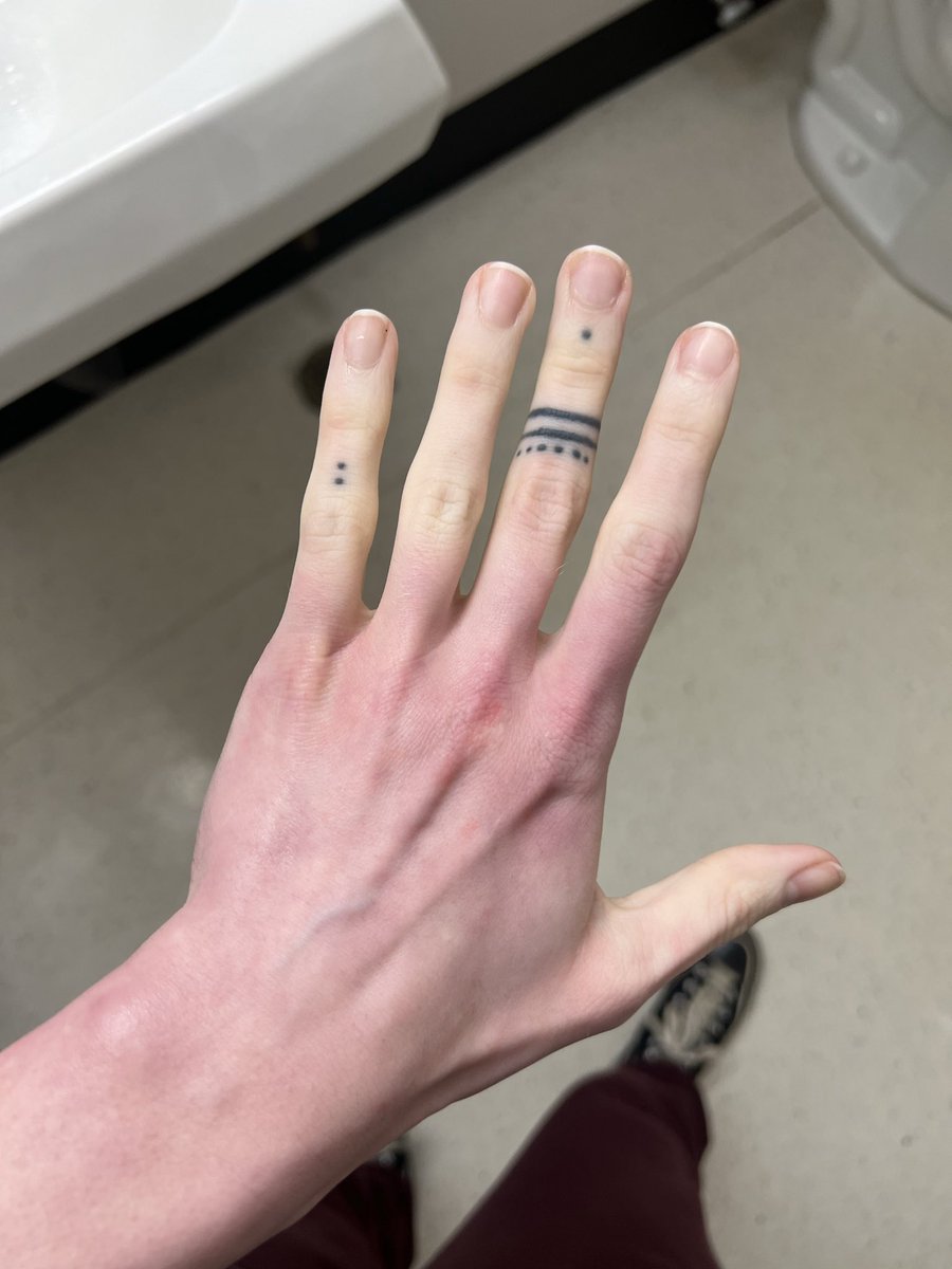 contextinspectr's tweet image. once again asking if anyone fw quirked up white girls with raynaud’s syndrome