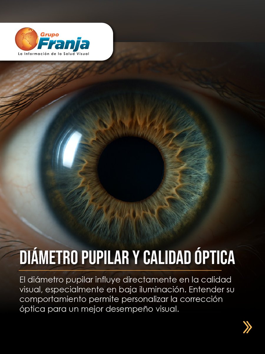 FranjaVisual's tweet image. La calidad visual cambia con el diámetro pupilar. Con aberrometría e IA, los lentes Free Form permiten personalizar la corrección según iluminación y tamaño pupilar.

👉🏾 f.mtr.cool/abtpnojxyh 👈🏾

#NotasFranja #Lentes #SaludVisualConEstilo