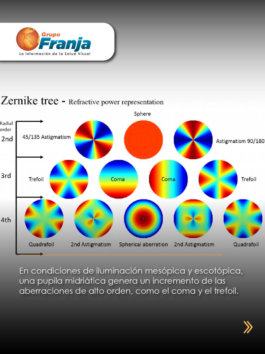 FranjaVisual's tweet image. La calidad visual cambia con el diámetro pupilar. Con aberrometría e IA, los lentes Free Form permiten personalizar la corrección según iluminación y tamaño pupilar.

👉🏾 f.mtr.cool/abtpnojxyh 👈🏾

#NotasFranja #Lentes #SaludVisualConEstilo