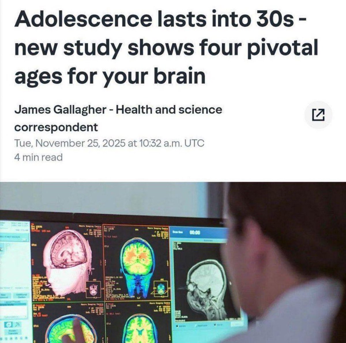 🧠 | El “cerebro adolescente” vive en nosotros hasta los 30, y no empezamos a envejecer realmente hasta los 66, según un nuevo estudio.

Científicos de la Universidad de Cambridge han descubierto que nuestro cerebro se reorganiza constantemente en respuesta a la experiencia y el