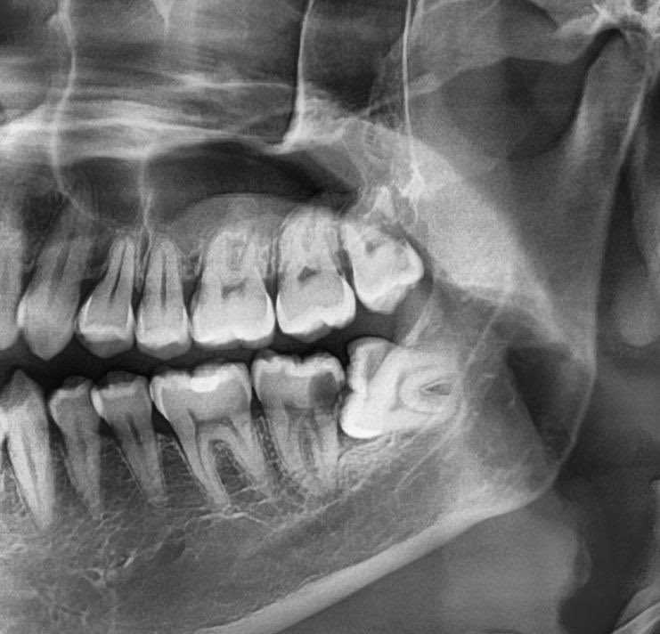 Bento 🍌 tweet media