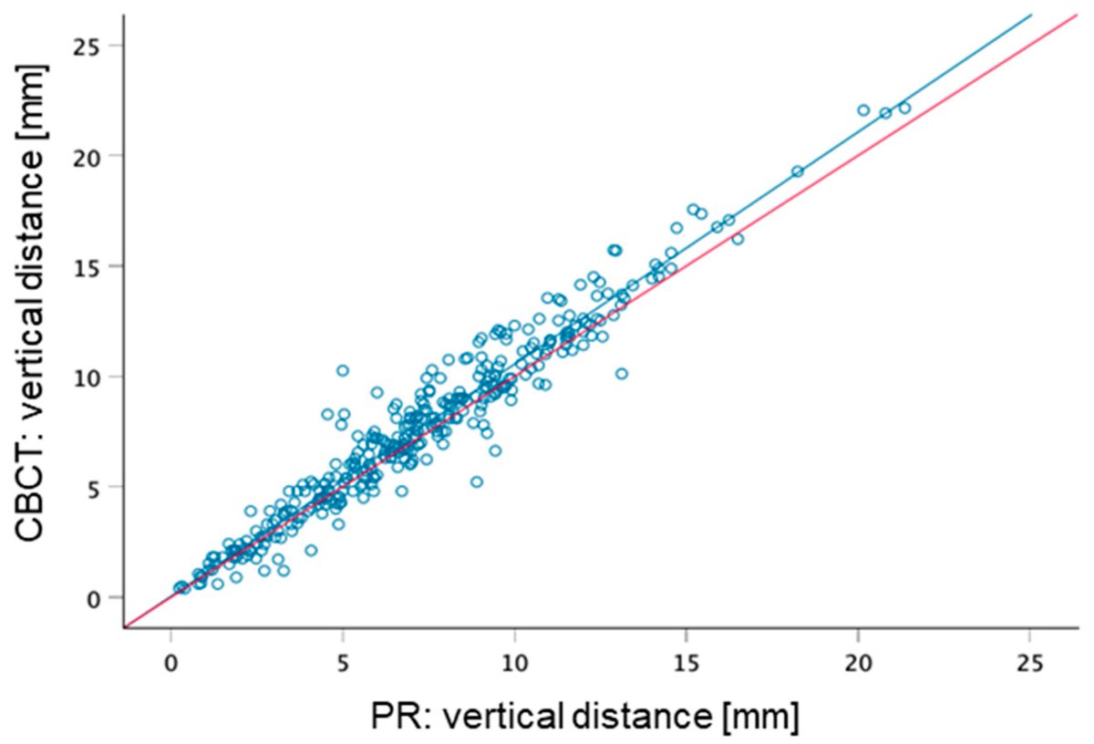 Prosthesis_MDPI's tweet image. Compare vertical measurements of panoramic radiographs &amp;amp; CBCT—robust data elevates prosthetic precision! 📊 This impactful study bridges imaging gaps for clinical excellence. 

doi.org/10.3390/prosth… 

#DentalImaging #Prosthodontics #CBCTResearch