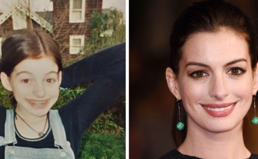Bitcoin is like Anne Hathaway, still in the early nerdy phase, but emerging as the quintessential beauty everyone desires.