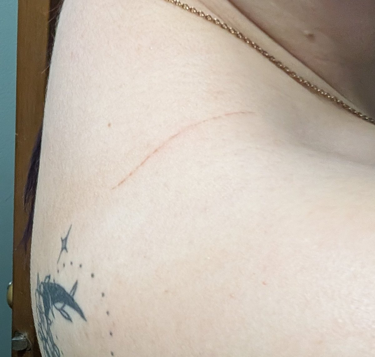 rosaly5678's tweet photo. I have always loved my bras from @Elomi_lingerie. But elomin WHAT IS THIS?!? I was wearing my favorite bra last week, and I noticed my shoulder was hurting a bunch, so I felt it. My hand came away BLOODY. I had to not wear that shoulder strap for the next 3 days. https://t.co/vzlqVsNL7p