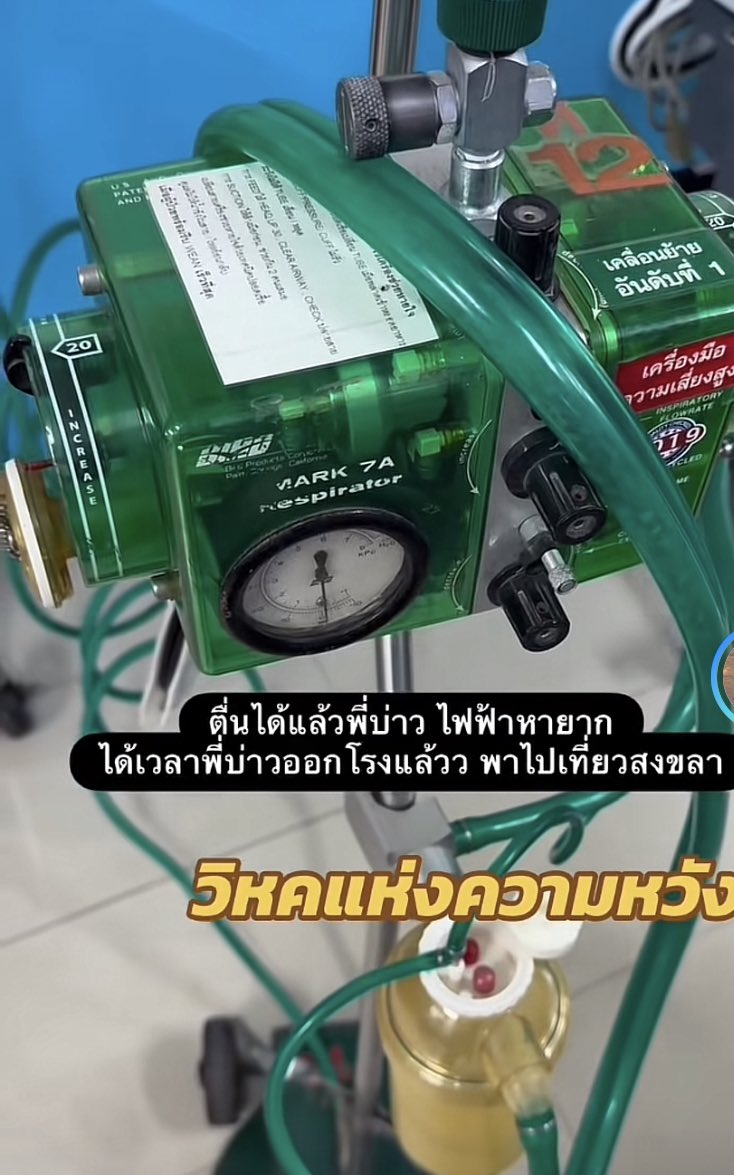 Sim_Cin's tweet image. อุปกรณ์ช่วยชีวิตช่วงไฟฟ้าดับแบบนี้
คนที่เกิดทันเครื่องนี้หร้าจะเกษียณกันเกือบหมดแล้ว นกเขียวในตำนาน(แล้วเห็นป้ายแปะเคลื่อนย้ายอันดับหนึ่งเอ็นดูนะ) สมัยก่อนน้องเป็นที่นิยมมากนะว่าไม่ได้ เคยเจอน้องครั้งเดียวเพราะ ventilator  หมดแล้วมีเคสต้องใช้