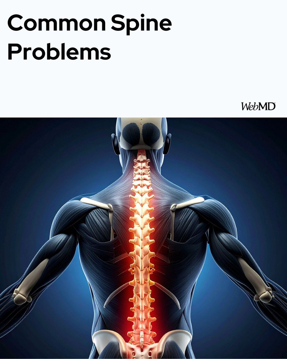 WebMD's tweet image. That stack of little bones along the center of your back has a key role to support and control your body. What happens when something&apos;s not right with your spine? Find out: wb.md/49yoCdG