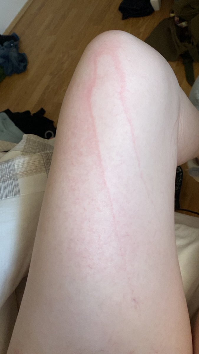 Ieatedthegrass1's tweet image. Whos yaoi dick imprinted on me