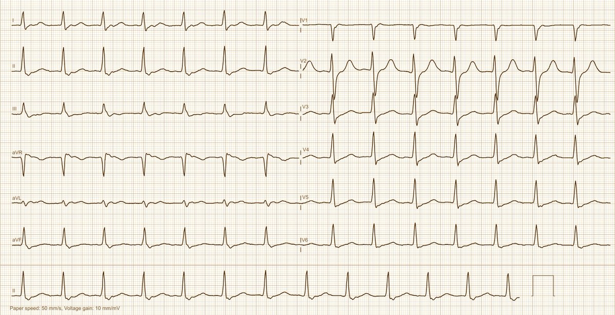 Dr. Andreas Roeschl tweet media