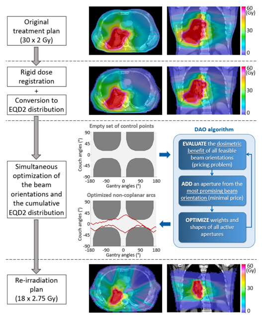jonas_willmann's tweet image. Re-irradiating recurrent NSCLC is challenging due to high cumulative OAR dose. Our automated non-coplanar planning approach reduces critical exposure while maintaining coverage ➜ safer thoracic re-RT 🔄🎯

doi.org/10.1016/j.phro…

@RadOncUSZ @Unispital_USZ #radonc
