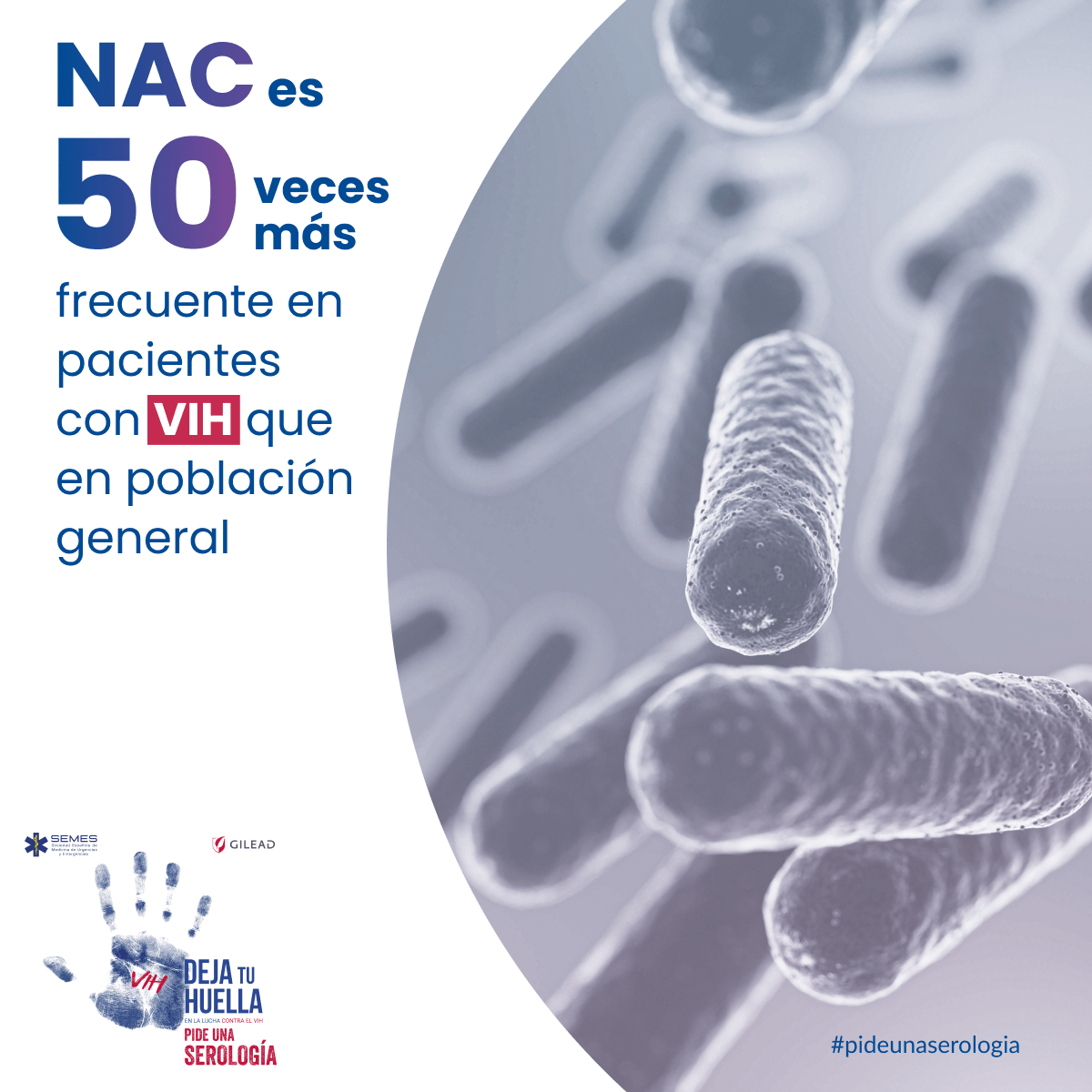 🌬️ La mayoría de las neumonías adquiridas en la comunidad (NAC) se atienden en urgencias.
Son una condición indicadora de posible infección por VIH.
🩺 Pide una serología.
#NAC #VIH #Urgencias #DejaTuHuella #DiagnósticoPrecoz