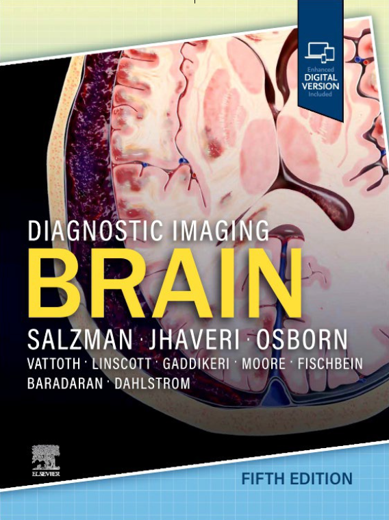🔔新刊入荷案内🔔 【Diagnostic Imaging: Brain, 5th ed.】 最新情報や