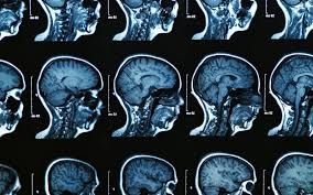 Cambridge Üniversitesi insan beyninin gelişimiyle ilgili tarihin en büyük çalışmasını yayımladı.

📍 0–90 yaş arasında 4.000’den fazla beyin taraması
📍 Nature’da bugün yayımlandı
📍 Beyin gelişimi 5 dönemde yeniden tanımlandı

Bugüne kadar bildiğimiz “çocuk–ergen–yetişkin”