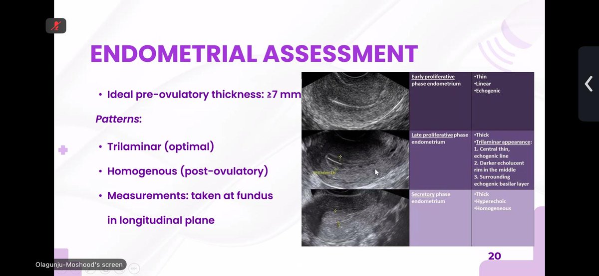 sonohive's tweet image. It was a great pleasure to host our first free ultrasound webinar session last Sunday!

Our eminent speaker, Mrs. Tawakalt Olagunju-Moshood, delivered a high-quality lecture.  We look forward to our next webinar!

#Webinar #Ultrasound #LearningTogether #Sonohive