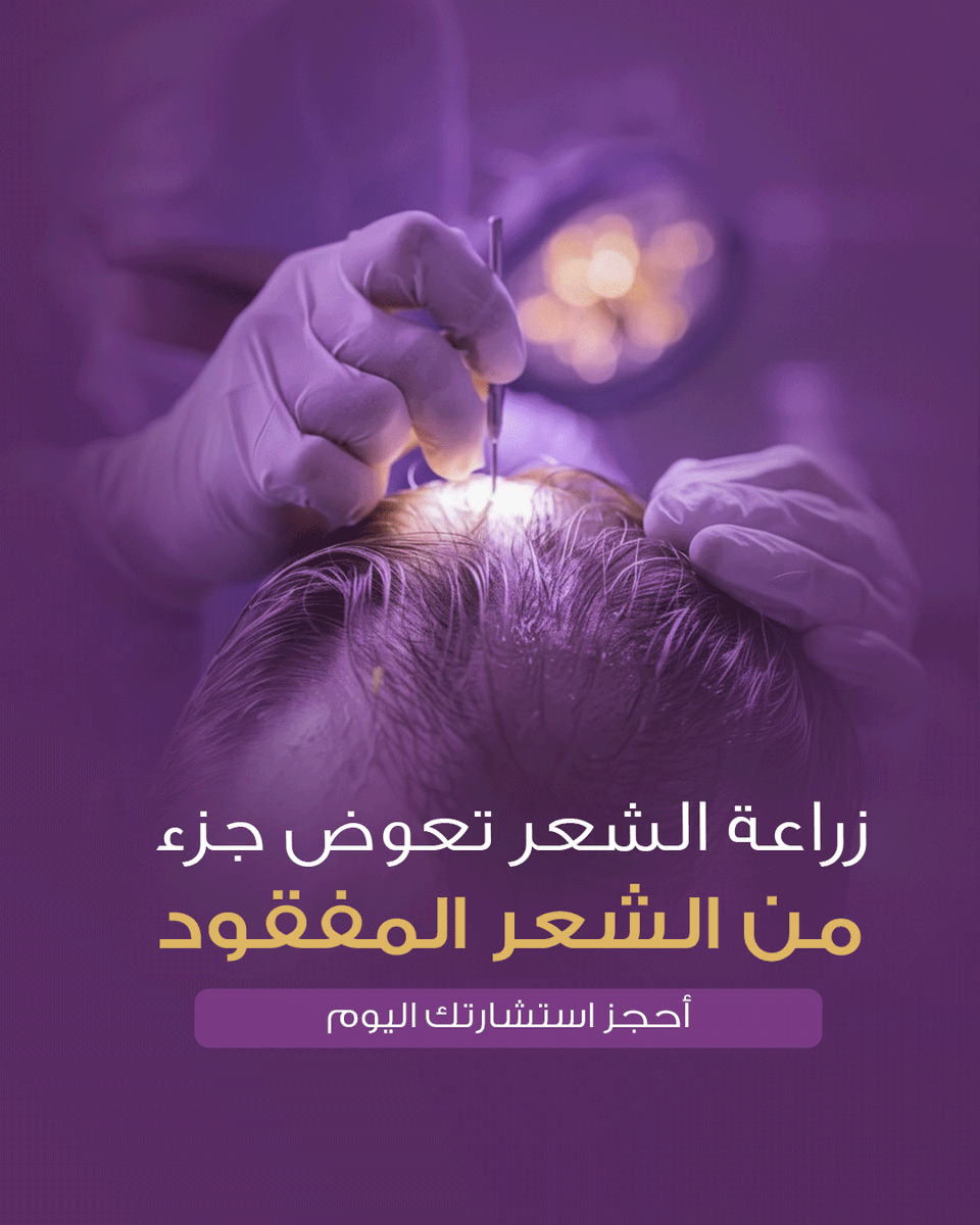 هل العلاجات تغني عن الزراعة؟
المينوكسيديل وحقن البلازما تقوّي الشعر… لكنها ما تعوّض الشعر اللي راح.
الزراعة هي الحل في حالات الصلع والفراغات.
احجز استشارتك اليوم 🌱
📍 أدمة – الرياض | 0550448814
#زراعة_الشعر #adamacenter #الرياض