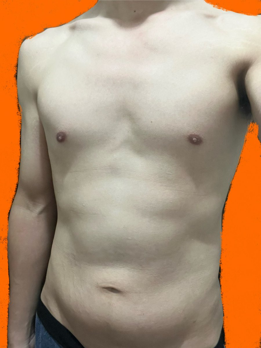 sVUUdfLUlmCBhTG's tweet image. 1セット:トレッドミル:1439kcal
時速:10.2km/h 時間:65:48秒

昨日の体重:72.5kg
今日の体重:71.4kg

体脂肪率:17.6%　
除脂肪体重:58.8kg
BMI:22.3
基礎代謝:1677kcal
内臓脂肪Lv:6.0
骨格筋率:43.9%
体水分:56.0%
#chocoZAP
#ダイエット仲間募集中
#トレッドミル
#ランニングマシン
#毒親育ち