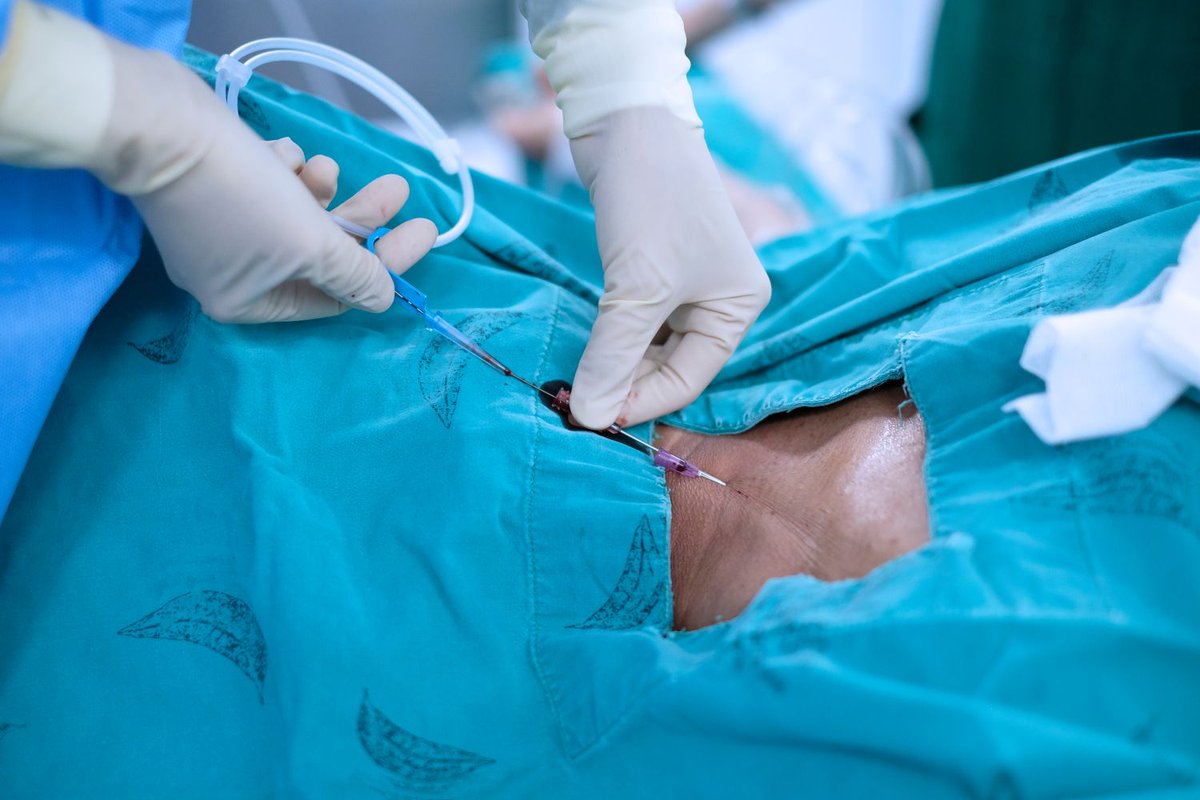 How guidewire technology is improving precision in critical medical procedures

As demand grows for safer, faster, and less invasive procedures, guidewire technology has become indispensable. Innovative new designs and manufacturing processes are advancing the precision of ...