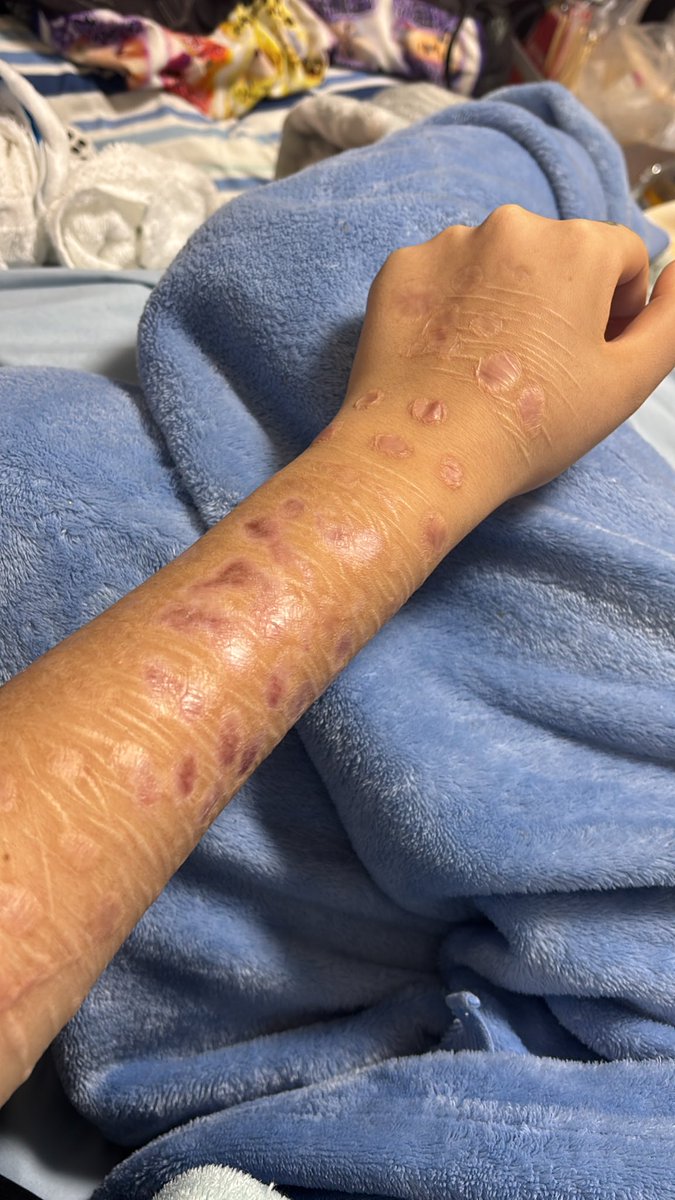 焼きたて8月から11月末現在