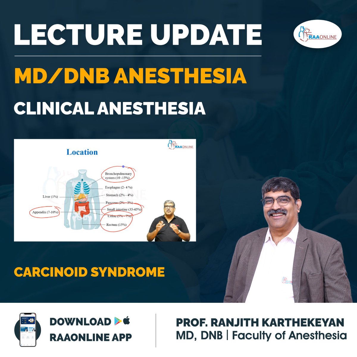 Raaonline's tweet image. Lecture Update in Anesthesia - Carcinoid Syndrome by Prof. Ranjith Karthekeyan on the RAAONLINE App.
Android: play.google.com/store/apps/det… 
IOS: apps.apple.com/in/app/raaonli…
Contact: +91-9994994266

#Raaonline #freelecture #lectureupdate #medicine #medicalstudent #medicaleducation