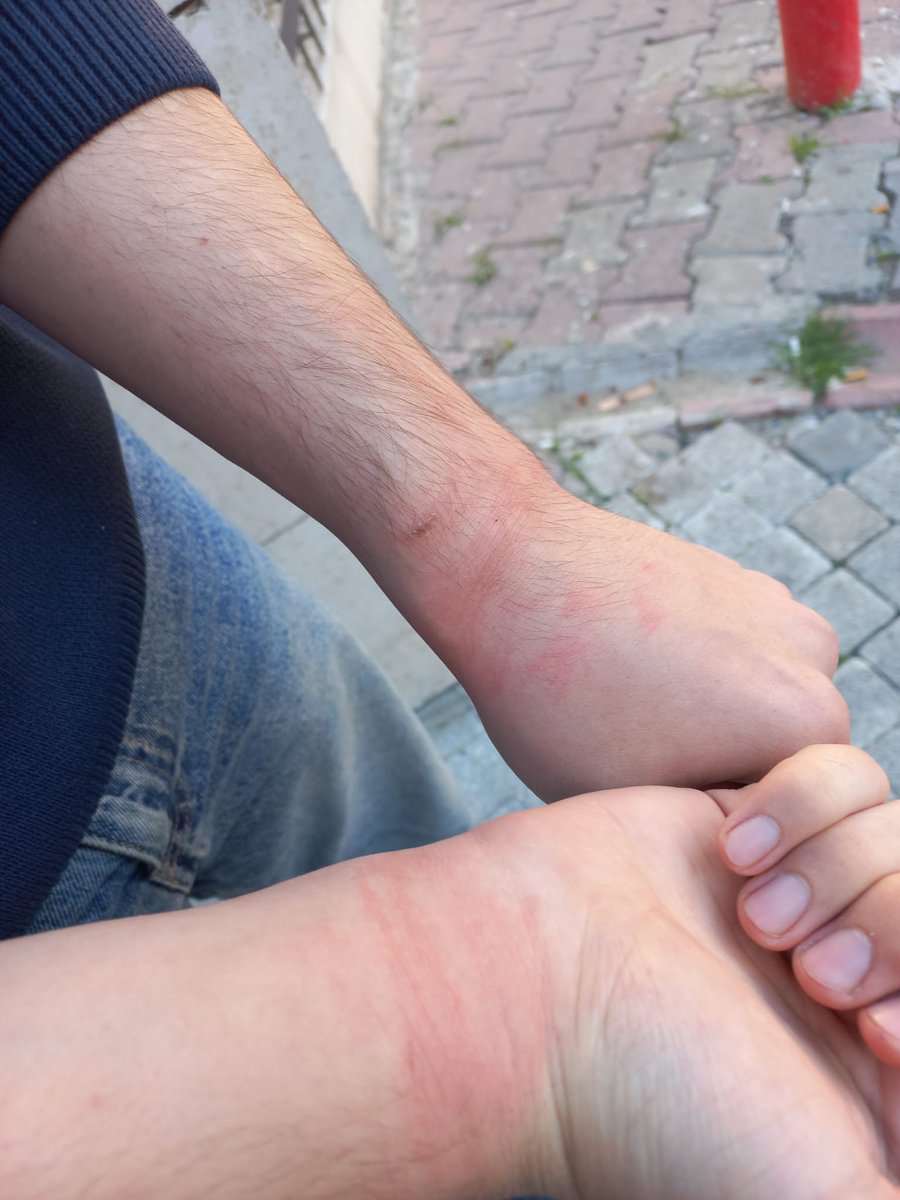 4tayadli1986's tweet image. Katil polis evlatlarımızın evlerini basıp ailelerinin gözü önünde işkence yapıyor! Evlatlarımıza yaptığınız işkencelerin, evlatlarımızın akan her bir damla kanının hesabını soracağız! İşkence yapmak şerefsizliktir!