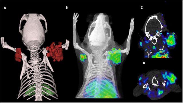 KernelReload's tweet image. InmunoPET: la ‘biopsia virtual’ que quiere cambiar el manejo del glioblastoma
kernelreload.blogspot.com/2025/11/inmuno…
#Oncology #Pets #Mascotas
