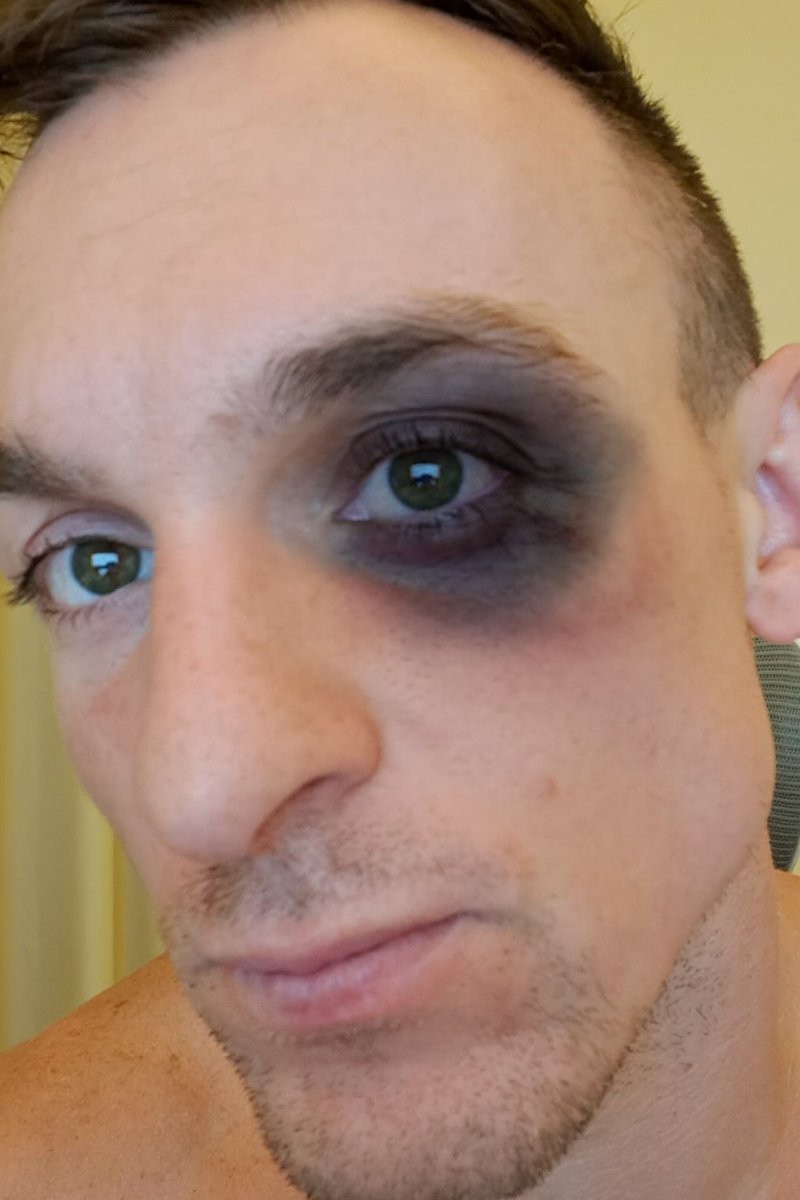 Black Eye-day
#BlackFriday