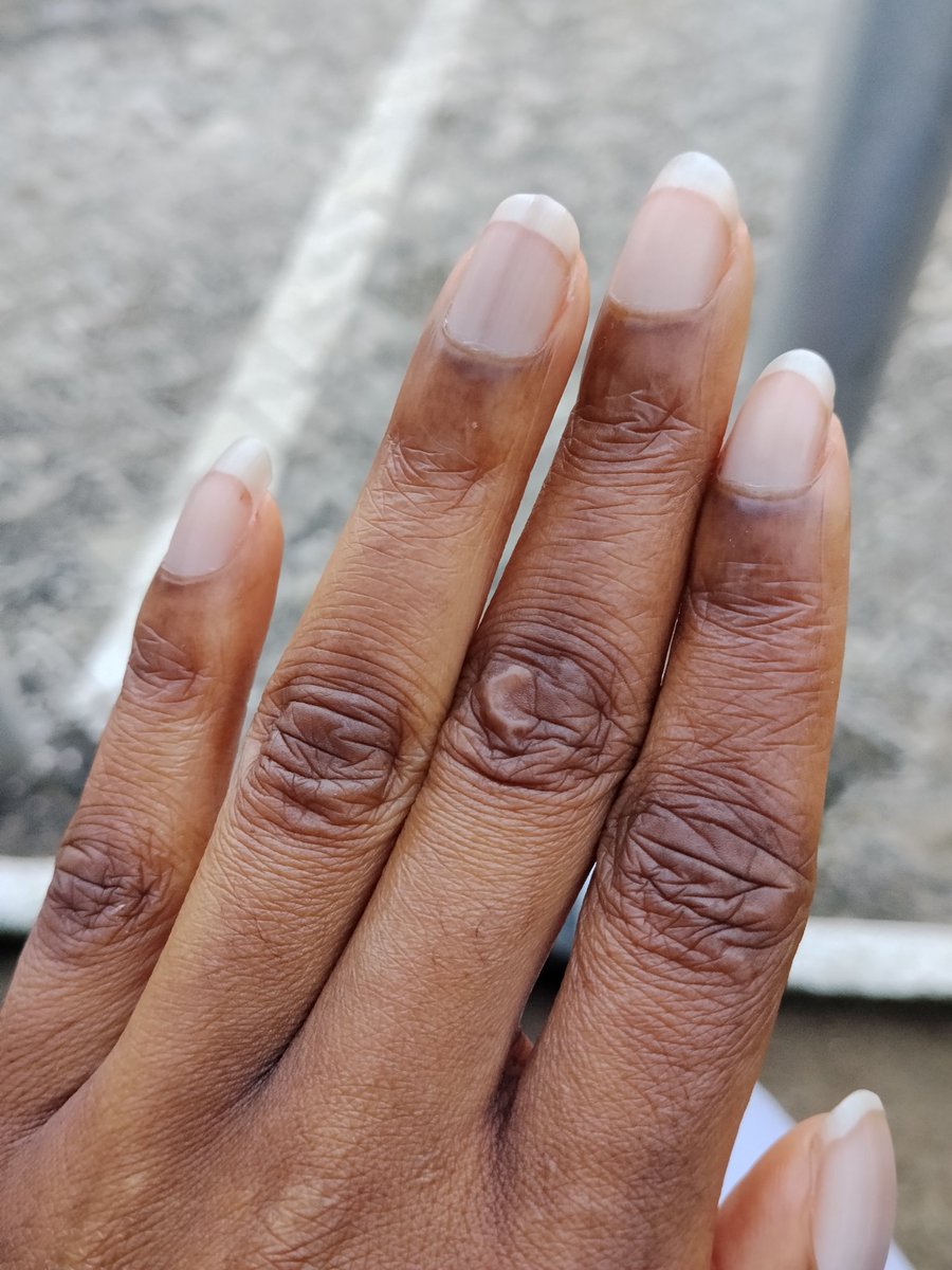 All mine♥️♥️