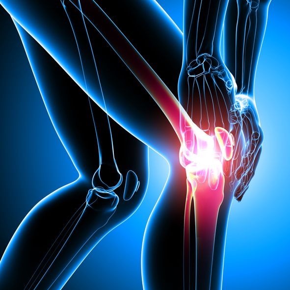 chrisboettcher9's tweet image. Joint pain after age 40 isn’t “aging” or bad luck.

It’s poor metabolic health destroying your joints.

By the time you’re in pain, they&apos;ve already been breaking down for years.

Here are the metabolic causes of joint pain (and 5 steps to fix them naturally to save your joints)👇…