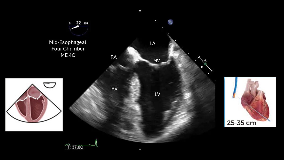 pocus.sg tweet media