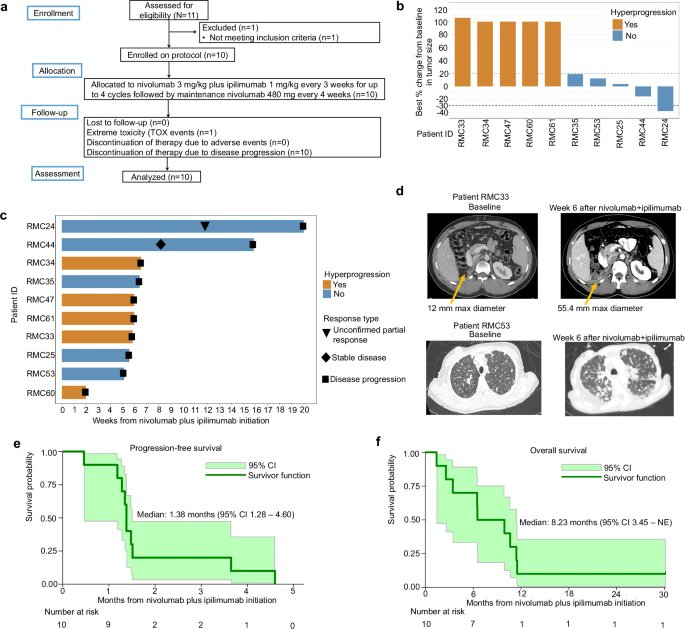 ⚡️ Hyper-progression with Nivolumab + Ipilimumab in RMC

Phase II data in renal medullary carcinoma show rapid progression in all treated patients, with half meeting criteria for hyper-progression. Single-cell analyses indicate an IFN-γ–driven “myeloid mimicry” program in