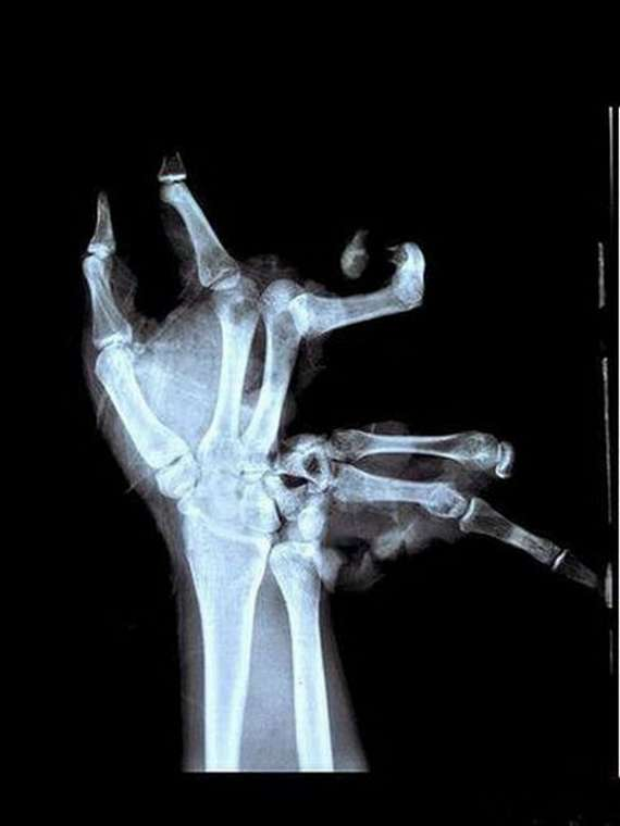 KommandoHelix's tweet photo. Someone thought it would be funny to replace the X-Ray I was working with with whatever the hell this is.
WHO DID THIS!?

-HELIX-CmD https://t.co/NnoKRw0jyC