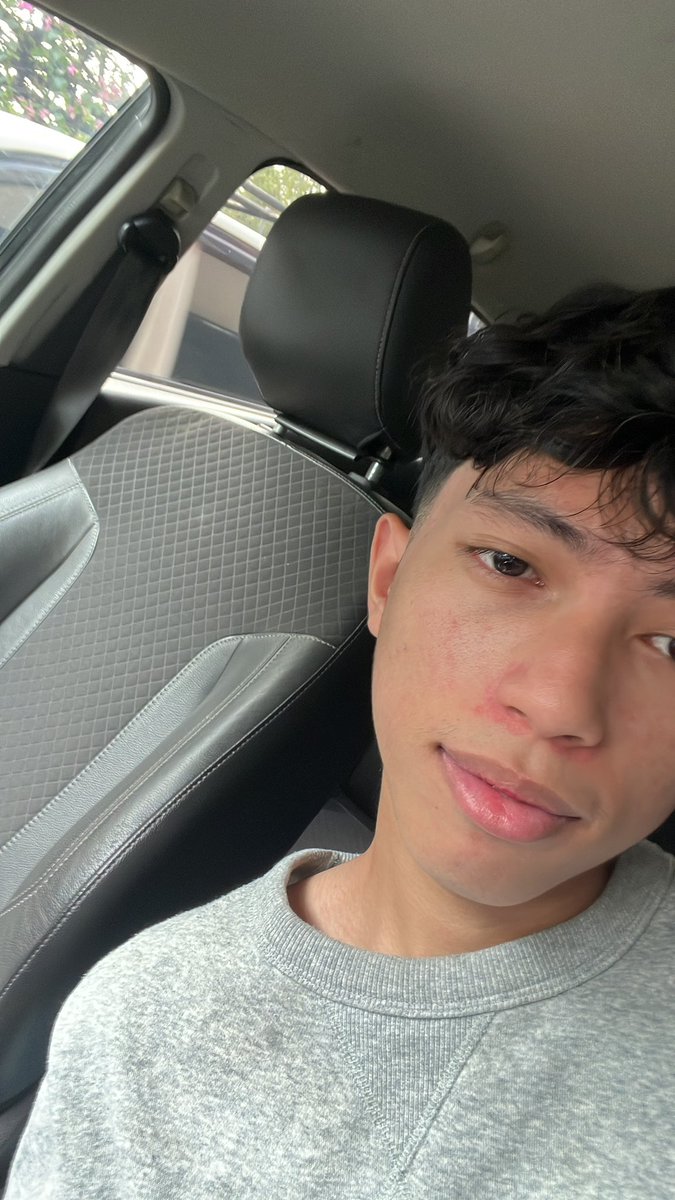 complexbrainrot's tweet image. loml saw this first