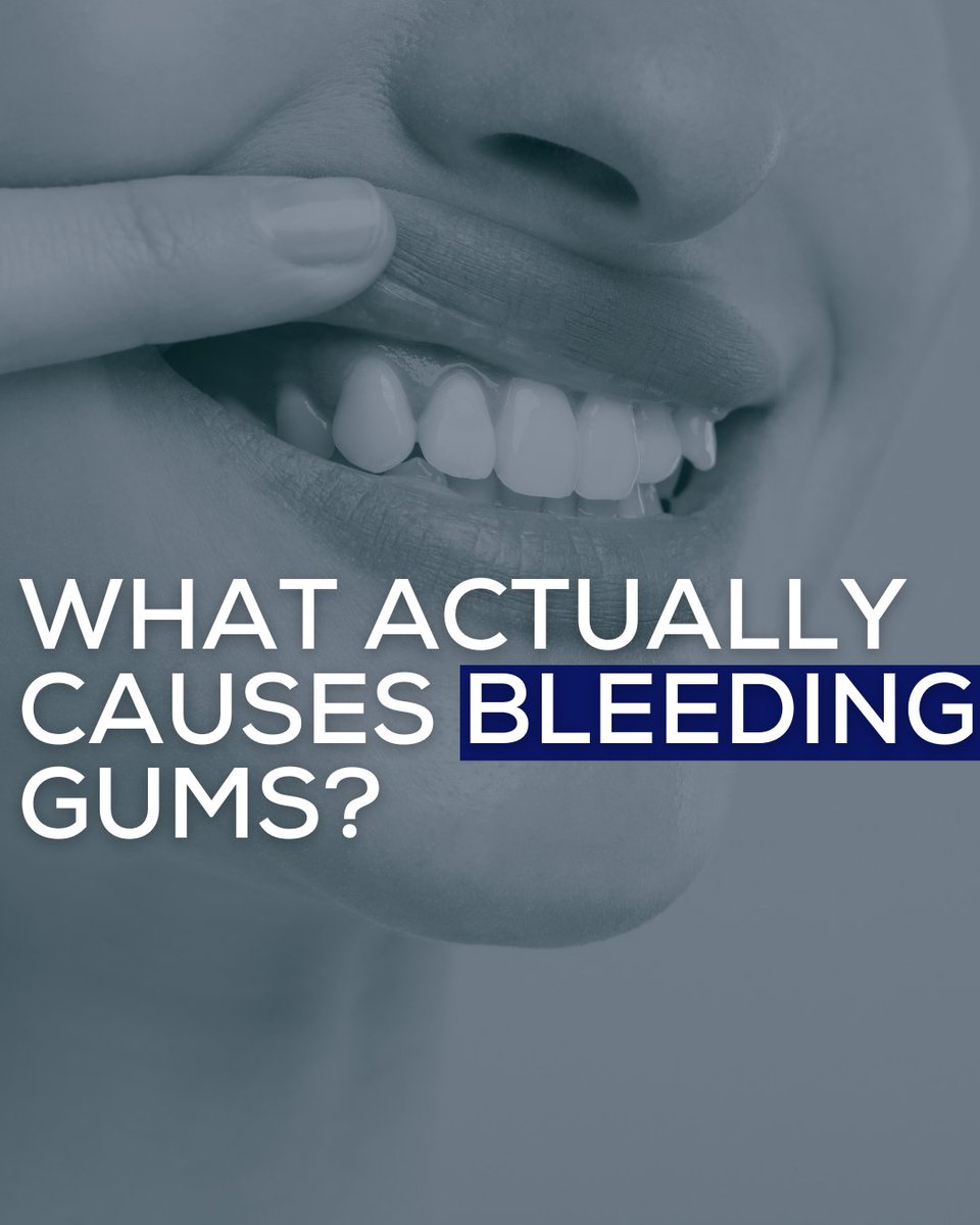 You brush &amp; floss. But your gums still bleed. Why?

A lot of people think it’s because they brush too hard, but that’s often not the  cause.

The truth is: bleeding gums are not normal. They’re a sign of something deeper, and they’re often the first warning your mouth gives you.