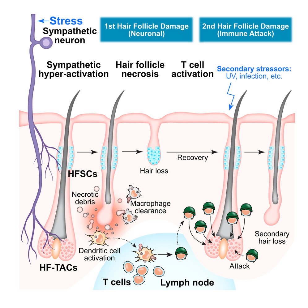 Stress-induced sympathetic hyperactivation drives hair follicle necrosis to trigger autoimmunity: <a href="/CellCellPress/">Cell</a>  cell.com/cell/fulltext/…