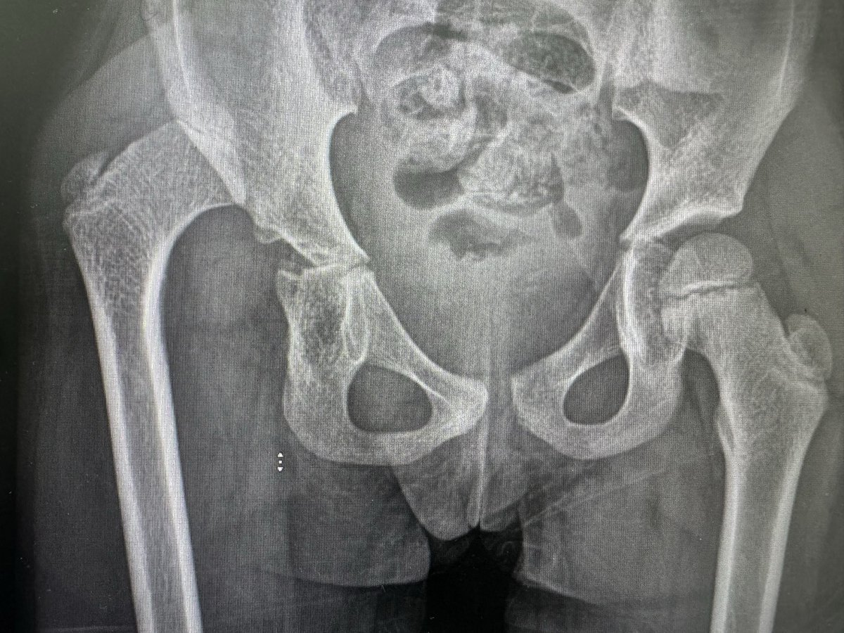 د. نبيل العساف، إستشاري جراحة عظام وعمود فقري tweet media