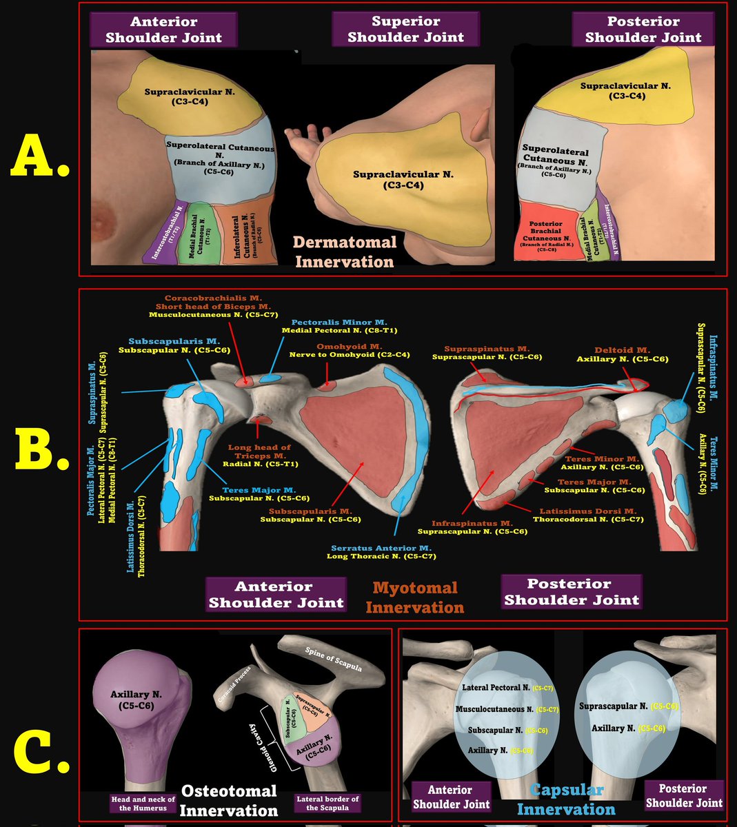 KartikBSonawane's tweet image. 🩺 How I Did It: Single-Stage Bilateral Shoulder Reduction Without Sedation or GA 💪

#HowIDidIt #UpperTrunkBlock
#BilateralBlock #PhrenicSparing
#SedationFree #AirwaySafe
#PrecisionRA #RegionalInED
#FastTrackRA #EDAnesthesia
#TipOfTheDay #MyRATips

Tip of the Day:

👨‍⚕️ A young…