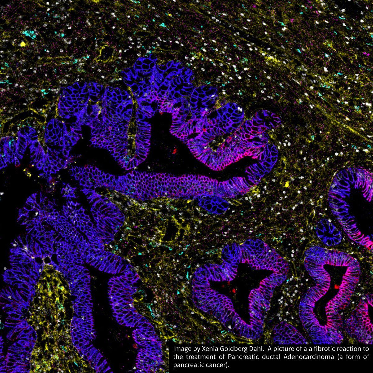 EuroBioImaging's tweet image. 🌍 #ImagingWednesday goes to Denmark! 🇩🇰✨

Catch the full series on Instagram, featuring stunning images from not only Danish Bioimaging.

📸 Follow @eurobioimaging (buff.ly/c87QwgL)