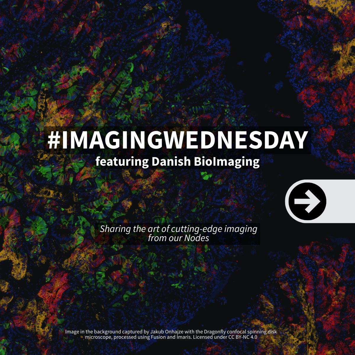 EuroBioImaging's tweet image. 🌍 #ImagingWednesday goes to Denmark! 🇩🇰✨

Catch the full series on Instagram, featuring stunning images from not only Danish Bioimaging.

📸 Follow @eurobioimaging (buff.ly/c87QwgL)