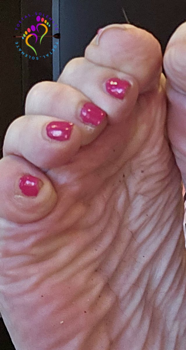 They need a cleaning and a pedicure 👣