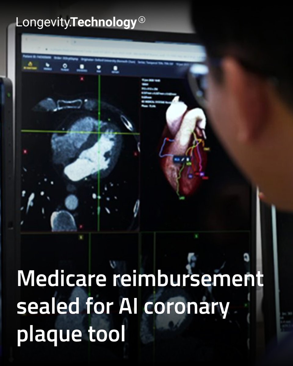 LongevityTech's tweet image. Medicare finalizes reimbursement for CaRi-Plaque, giving hospitals and clinics a unified route to adopt AI-powered coronary plaque analysis.

longevity.technology/news/medicare-…

#longevity #AIhealth #cardiology #Medicare #healthtech #digitalhealth