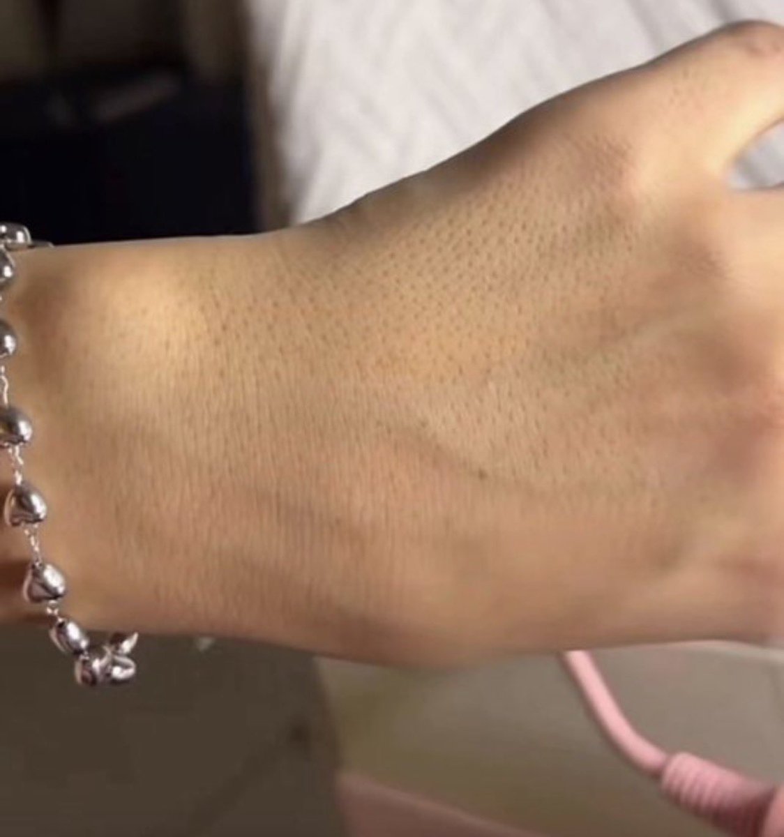 بنات والله صدق ومو مبالغة اذا تعانين من المسامات باليد والله مالك الا ليزر اورسلا كير يشيل الشعر ونتايجه سريعة صارلي ٤ سنوات استخدمه والحمدلله مالي فالعيادات الا وقت الزواج او ليلة العمر ..
وهذا كىود خىصم LOS يخصملك 100 ريال والتوصيل مجاناً والله دلع.
urslacare.com/ar