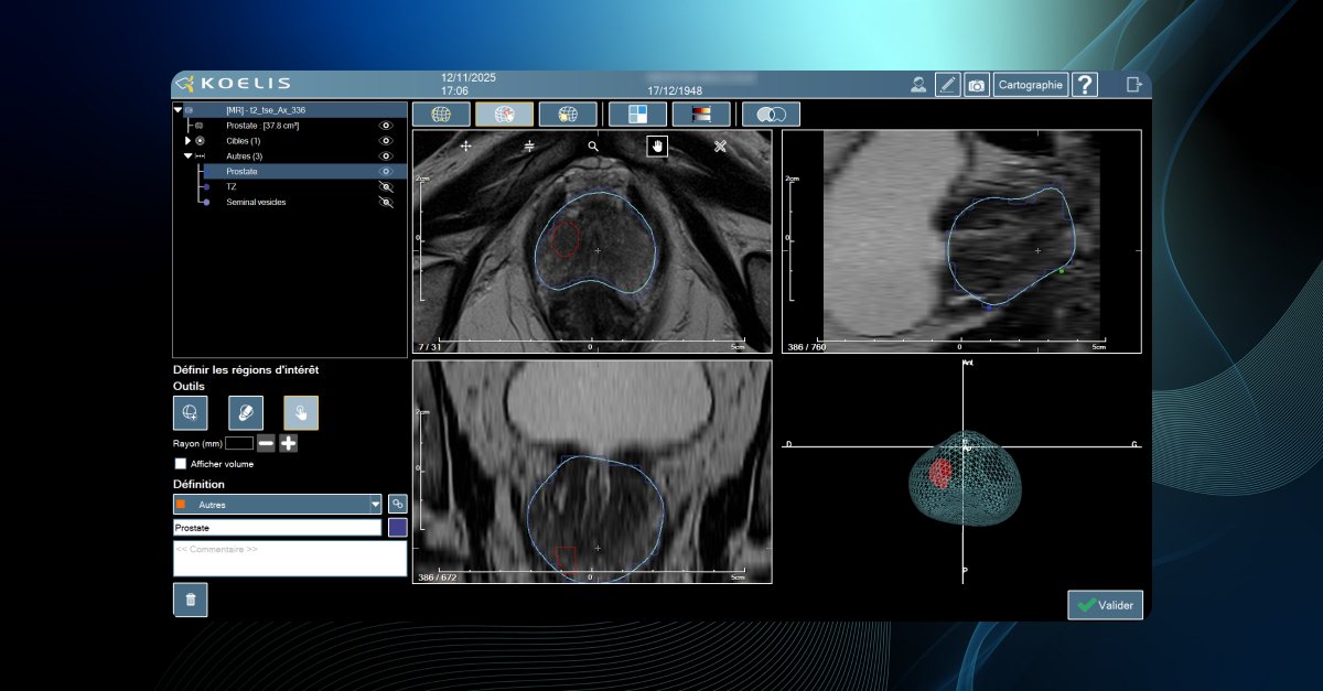 Lucida Medical tweet media