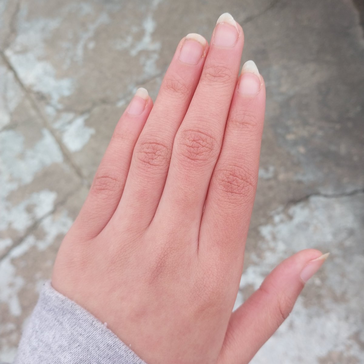 freakenomenon's tweet image. being lightskin in the winter is hell why are my hands racially ambiguous