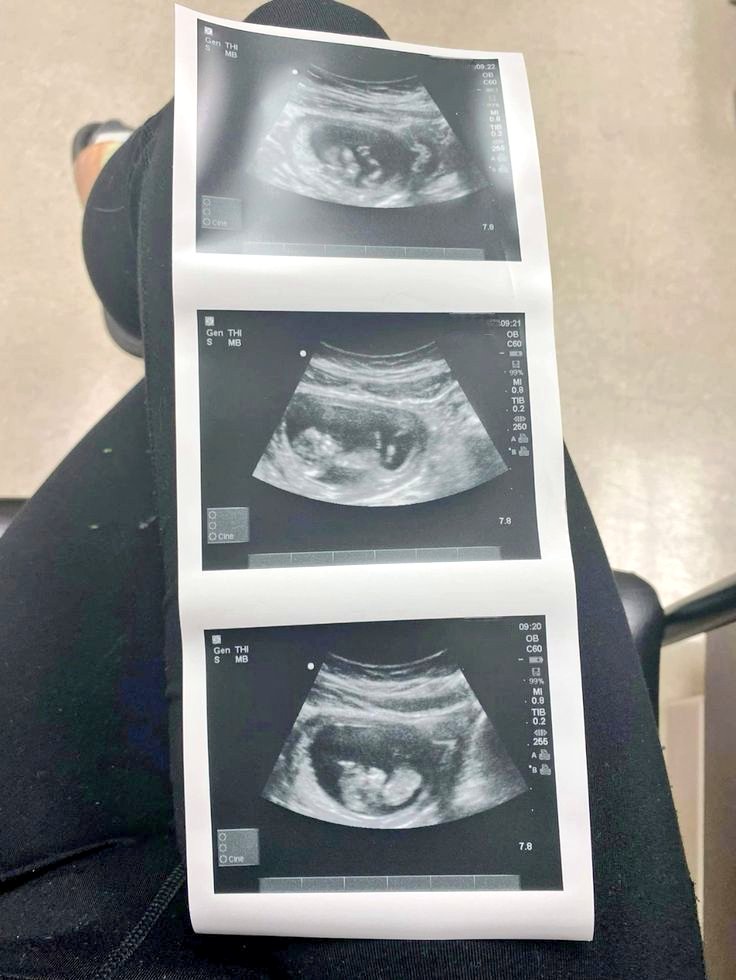 Rozana_0l's tweet image. Alsalam alaykum 🦋

I am on the verge of giving birth… and a thousand fears fill my heart.

I don&apos;t fear the pain as much as I fear for a small soul
that will be born into a cruel world before it knows mercy.

Lord, grant us strength.

chuffed.org/project/143426…