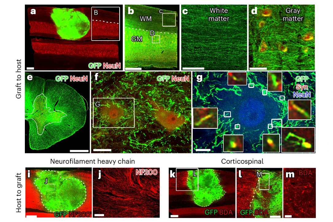 stemcellpodcast's tweet image. What a story! 🤯

A team at @UCSDNeuro grafted ESC-derived spinal cord #neural stem cells into non-human primates with #SpinalCordInjury, improving their hand function.

📎 @NatureBiotech - go.nature.com/3LOQsbG
🎧 - bit.ly/44kEZqM