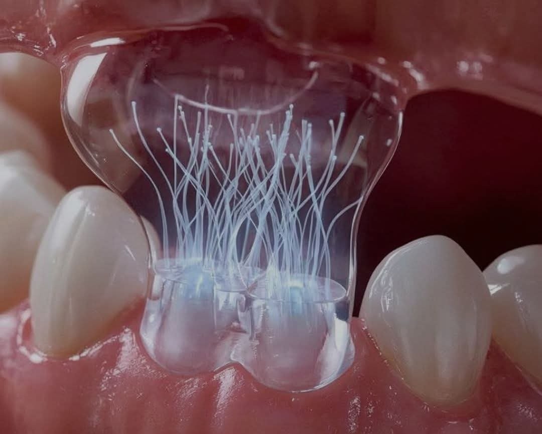 seigihakatta's tweet image. 歯が甦る⁉️

本物の歯を自然に再生できる小さな生理活性パッチで、入れ歯の時代を終わらせる可能性があるということです。

人工インプラントに頼る代わりに、このパッチは顎の中の体自身の幹細胞を活性化し、エナメル質、象牙質、さらには完全な歯の構造の再生を開始します。…