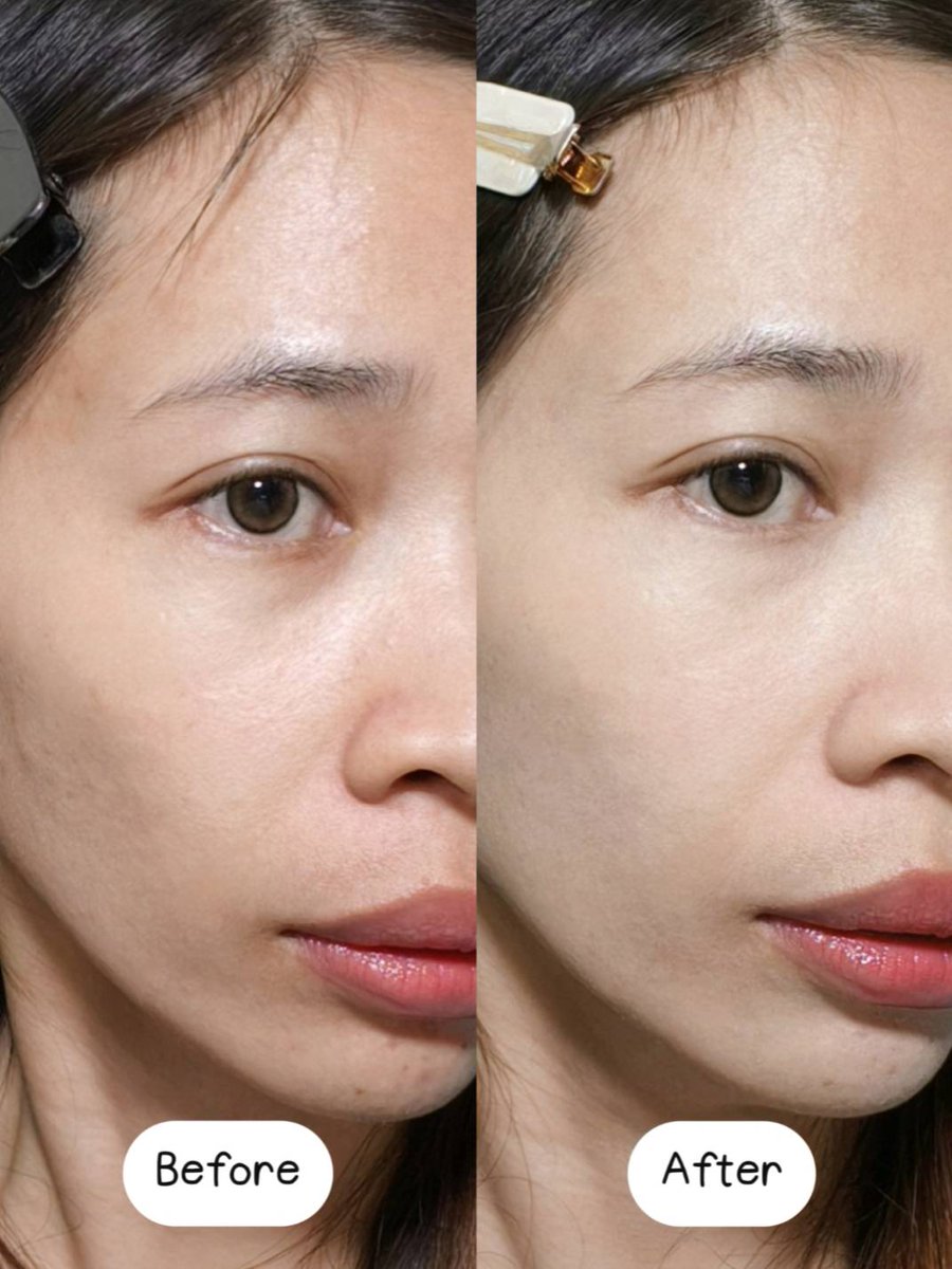 ล่าสุด NU FORMULA สูตรนี้มีแบบซองขายที่ 7-11 แล้วว

ในที่สุด เจลครีมบูสต์ผิวไบร์ท NU FORMULA 🩷✨ ก็มีแบบซองสักที เวลาไปเที่ยวคือขก.พกแบบกระปุกมากกกก มีแบบซองละพกง่ายขึ้นเยอะ ประหยัดพื้นที่ในกระเป๋าสุดๆ แล้วหาซื้อง่ายด้วย นี่แวะ 7-11 ที่ไหนเจอที่นั่นตลอด