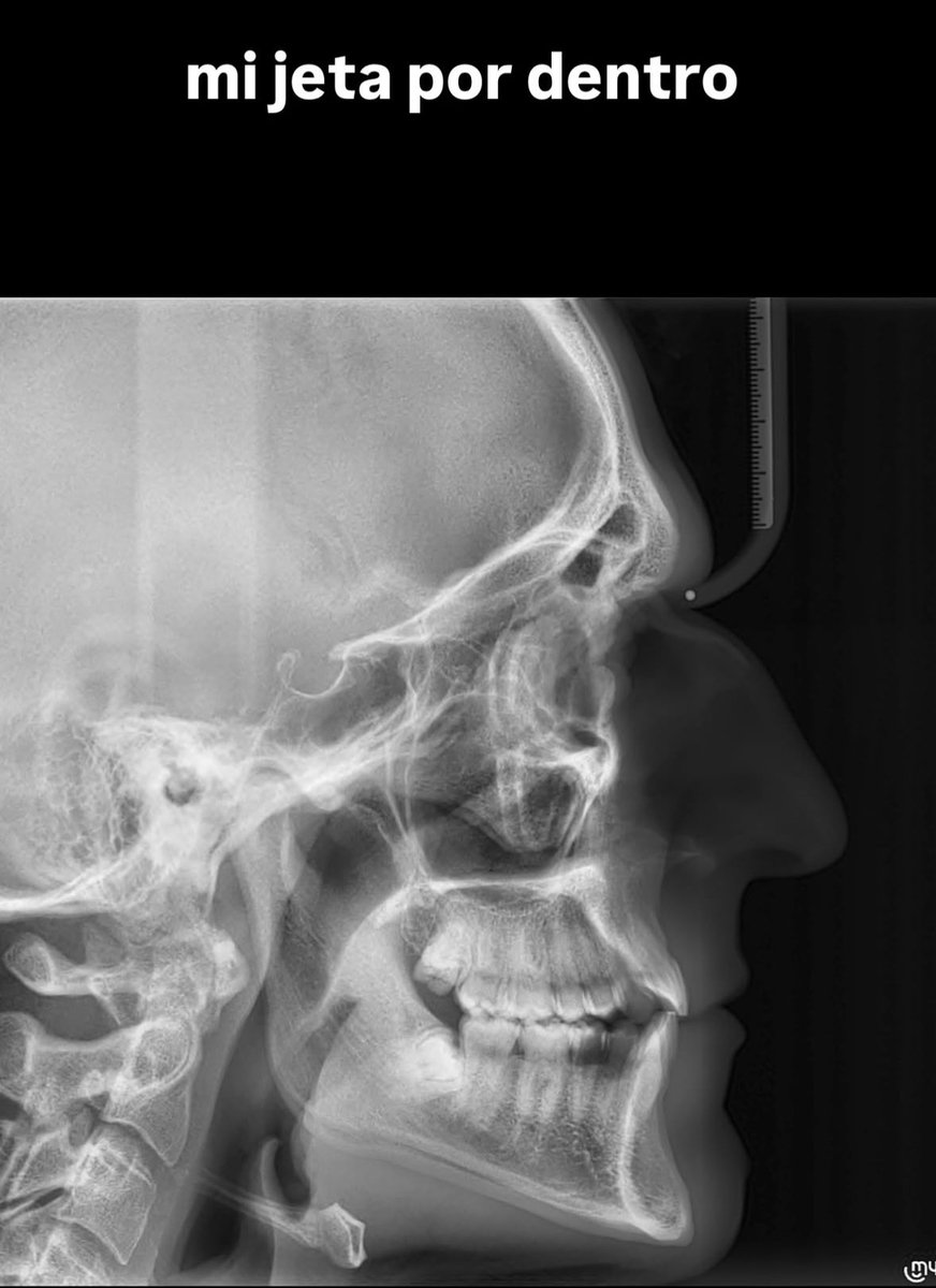 loutadata's tweet image. 🩻 | @/louta vía historias de ig